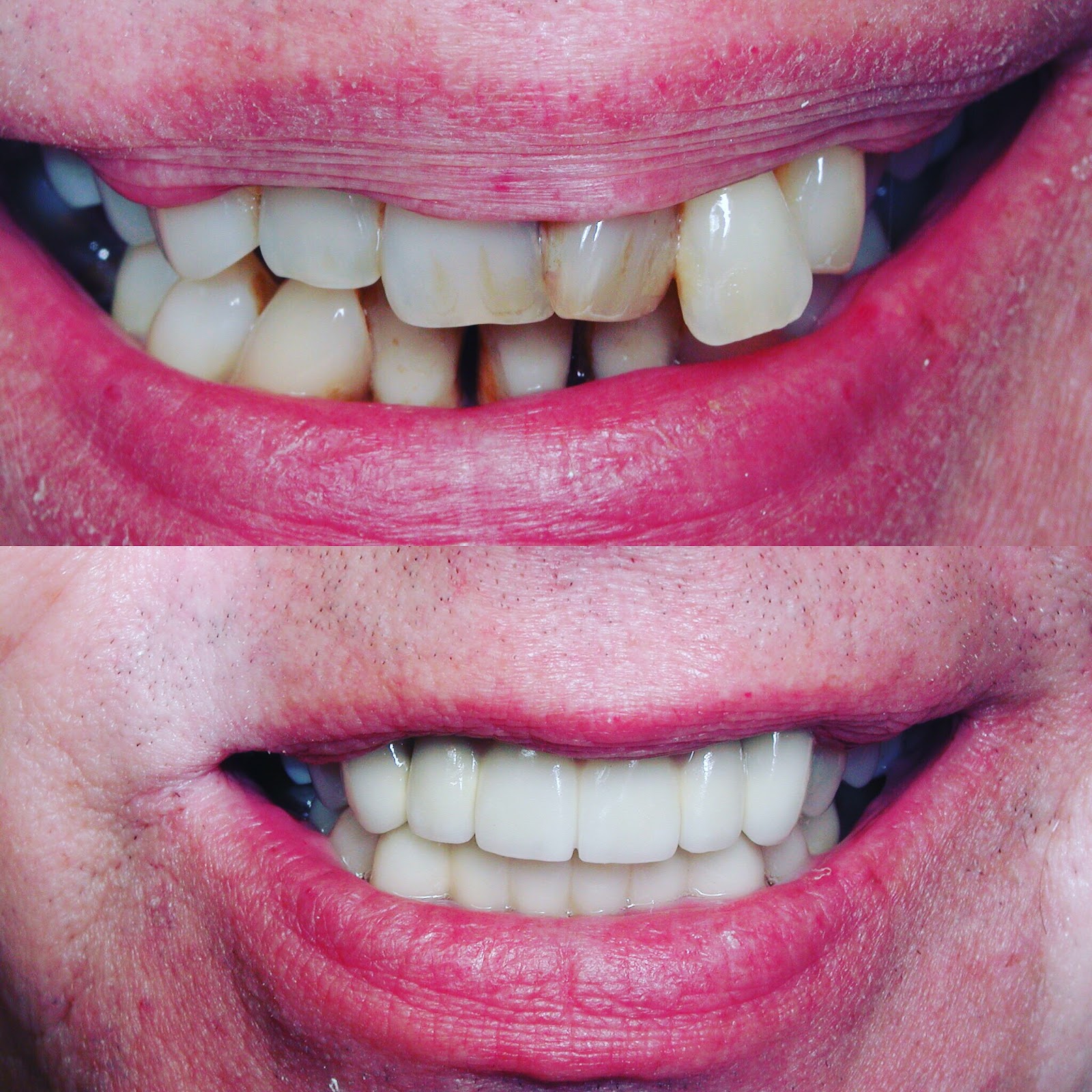 Tampa Smiles team